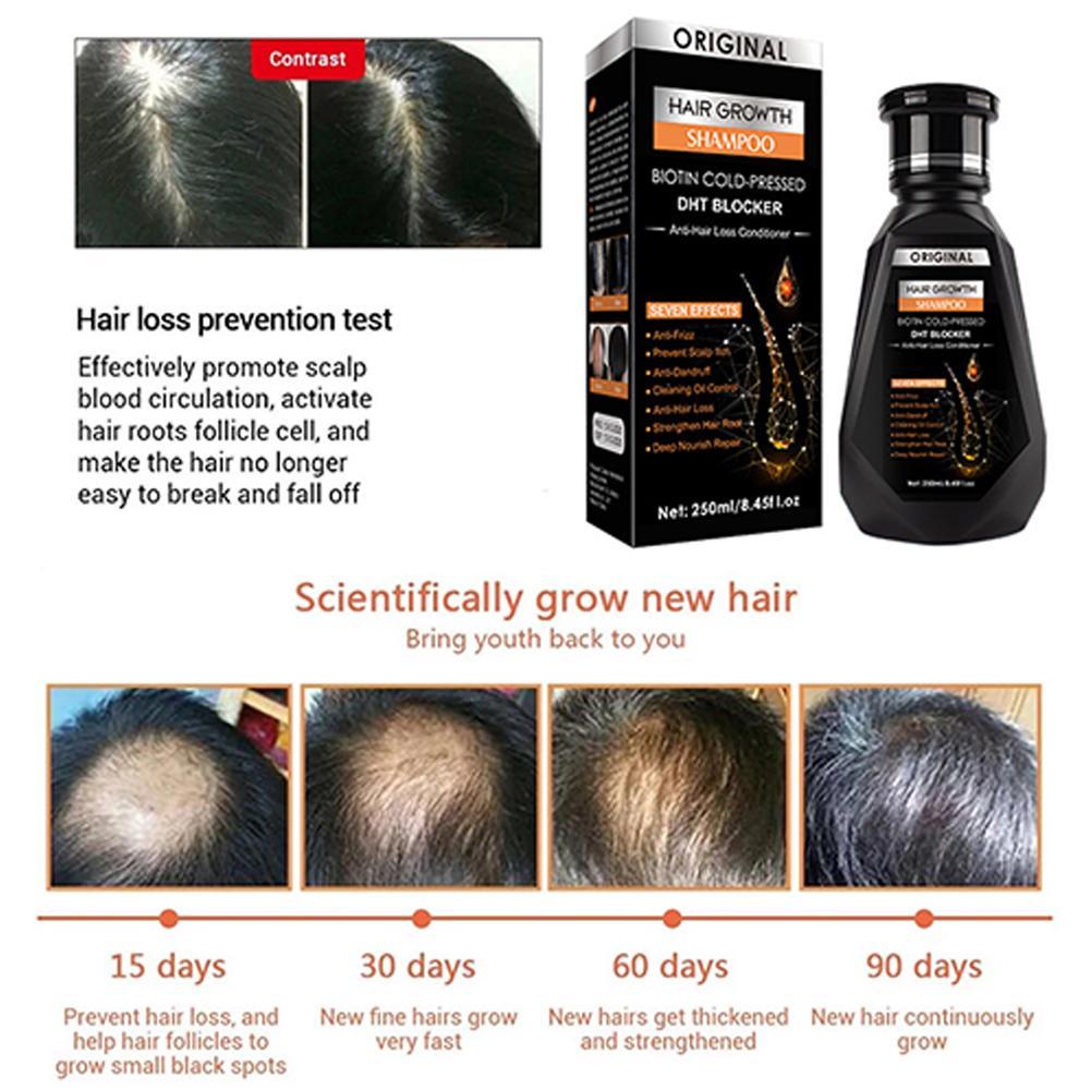 Biotina gengibre shampoo espes - Biotin Shampoo Thickening avaliação e preço