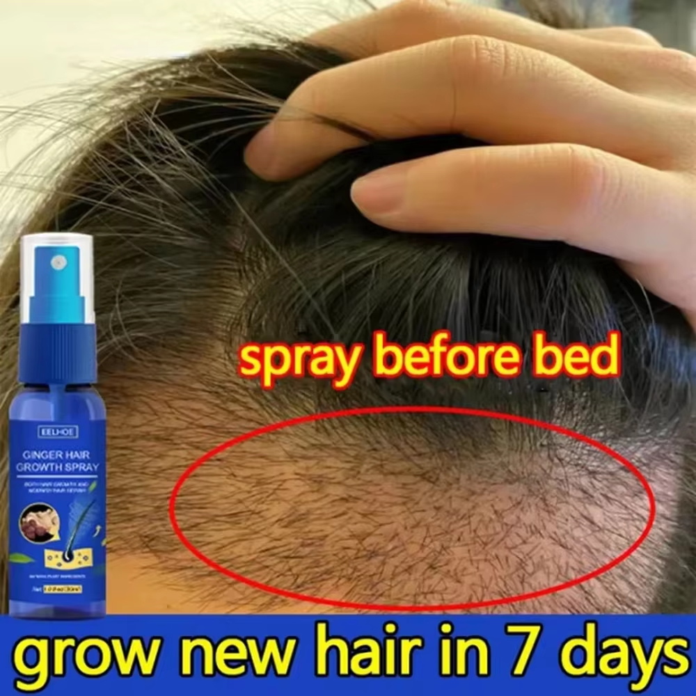 Spray de Crescimento Rápido de - Hair Growth Serum Oil avaliação e preço