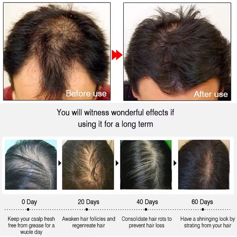 Spray de Crescimento Rápido de - Hair Growth Serum Oil avaliação e preço